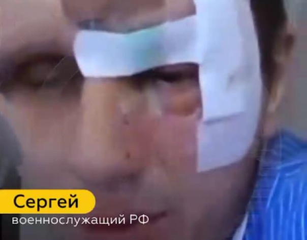 Боец ВСУ три дня выхаживал взявшего его в плен российского военного.