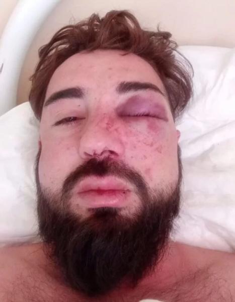 «Русским теперь дома нужно сидеть?» Кто ответит за избиение в Балаково мужчины, заявившего о поддержке СВО?