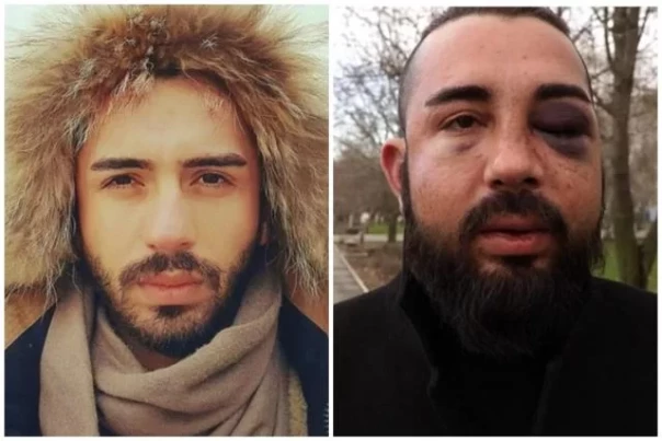 «Русским теперь дома нужно сидеть?» Кто ответит за избиение в Балаково мужчины, заявившего о поддержке СВО?