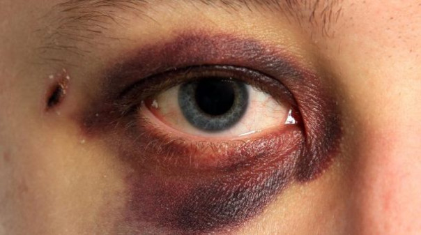 Бьют по морде, а не по паспорту (новое прочтение)