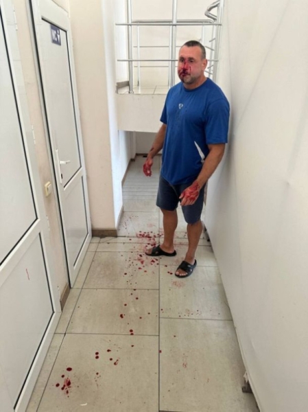 Фитнес-тренера, обматерившего украинских военных, отдали на расправу &laquo;азовцам&raquo;