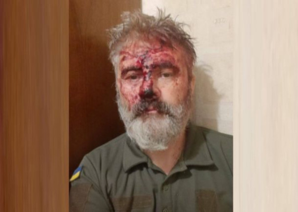 В Киеве избили священника, служащего в ВСУ