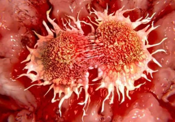 В России создан препарат от рака, не имеющий аналогов в мире