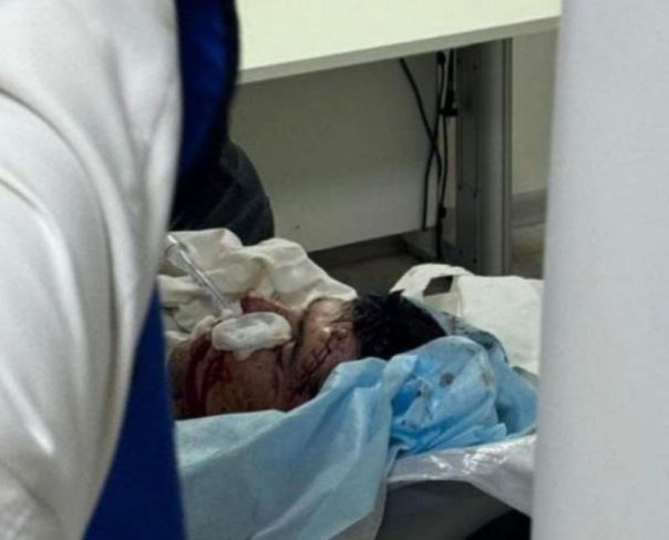 Дагестанский полицейский Мурад Магомедов сфотографировался сразу после победы над террористом в ножевой схватке 18+