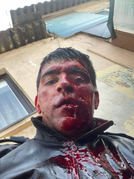 Дагестанский полицейский Мурад Магомедов сфотографировался сразу после победы над террористом в ножевой схватке 18+