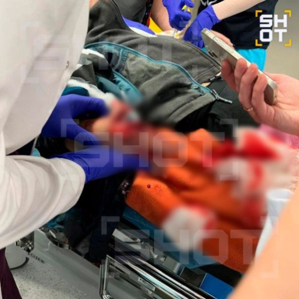 Вопиющий случай: в подмосковном Красногорске ребёнку разворотило взрывом кисть, когда он поднял деньги на детской площадке