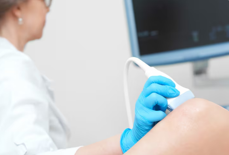 Эхосклеротерапия: современный подход к лечению венозных проблем