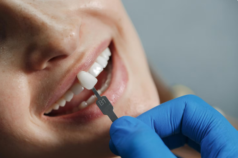 Имплантация зубов: современный способ восстановления улыбки