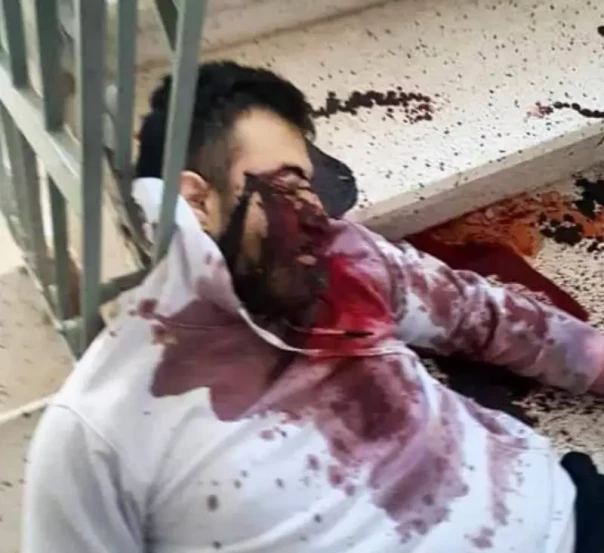 Геноцид в Сирии, как точка невозврата (21+)