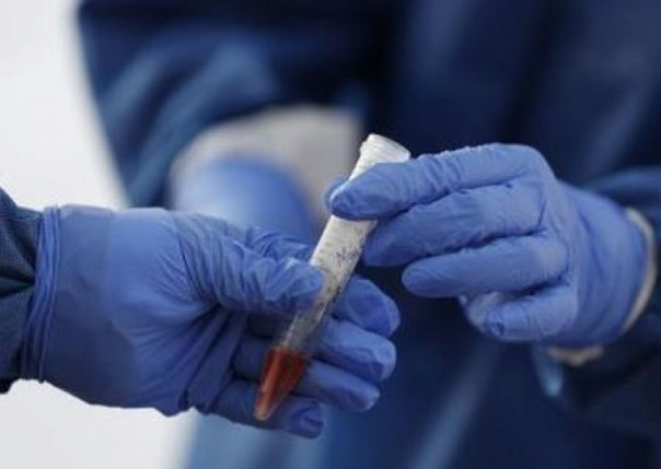 На Украине разоблачили схему массовой подделки ПЦР-тестов